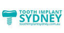 Tooth Implant Sydney